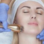 Radiofrequency Face Lifting | 30min 12